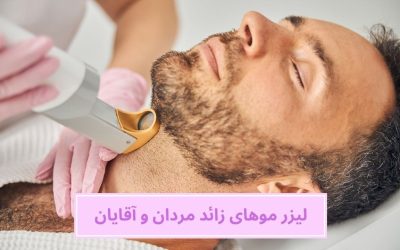 همه چیز در مورد لیزر موهای زائد مردان و آقایان