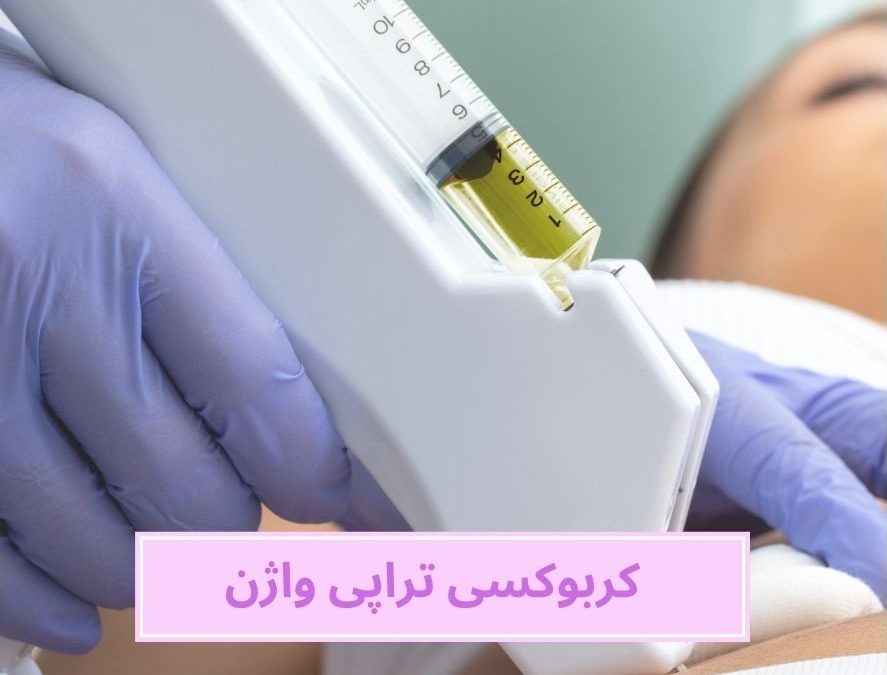 کربوکسی تراپی واژن، هر چیزی که باید بدانید