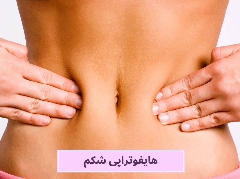 هایفوتراپی شکم: درمان، هزینه و کاربردها