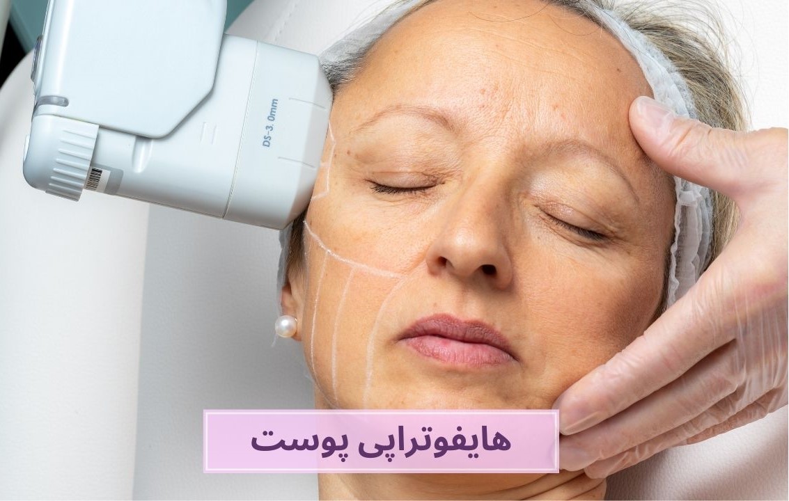 هایفوتراپی پوست