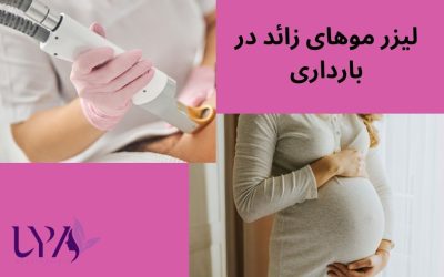 لیزر موهای زائد در بارداری: خطرات و احتمالات