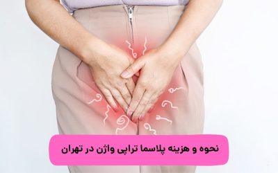 نحوه و هزینه پلاسما تراپی واژن در تهران