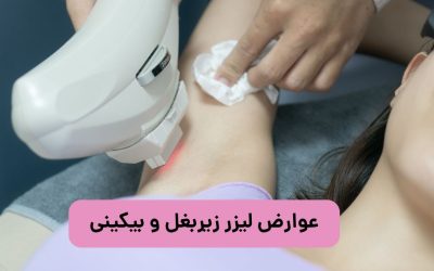 عوارض لیزر زیر بغل و بیکینی چیست؟