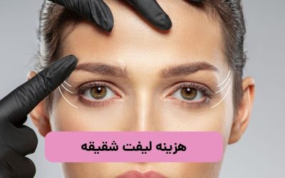 هزینه لیفت شقیقه در سال 1403 چقدر است؟