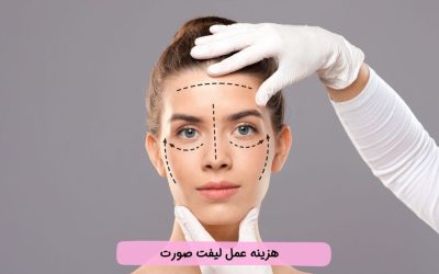 هزینه عمل لیفت صورت در سال 1403 چقدر است؟