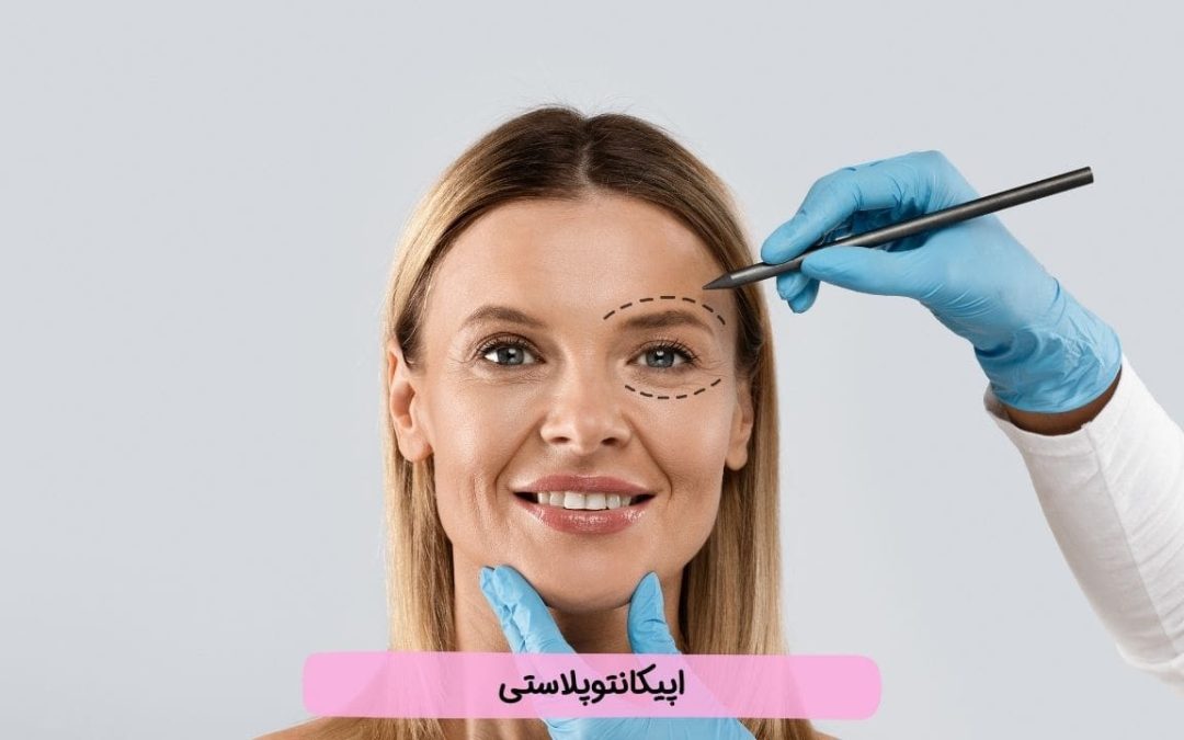 اپیکانتوپلاستی یا جراحی بزرگ کردن چشم