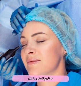 بلفاروپلاستی با لیزر