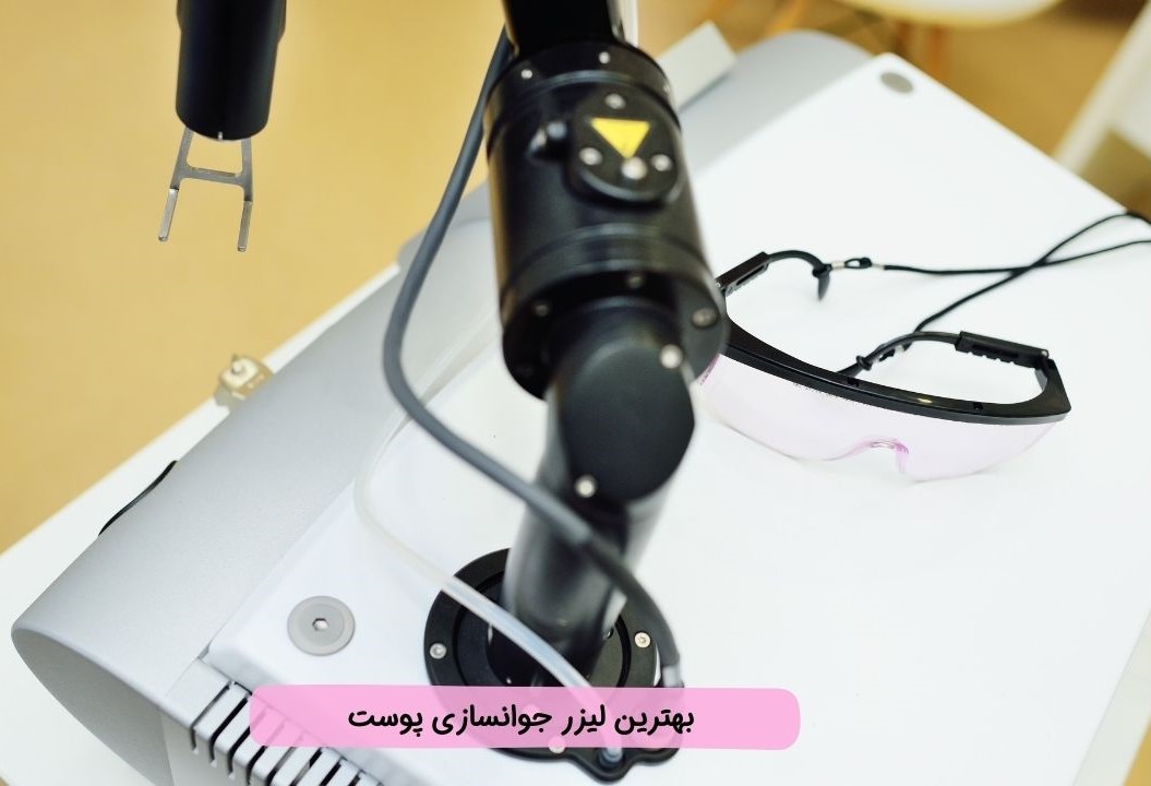 بلفاروپلاستی با لیزر بلفاروپلاستی با لیزر