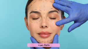 مادلینگ صورت