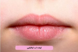 لیفت لب ایتالیایی