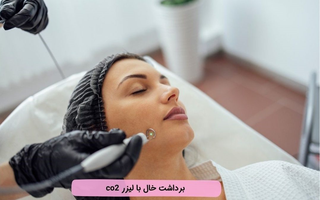 برداشت خال با لیزر co۲ فرکشنال: مزایا، مقایسه، نحوه برداشت و هزینه