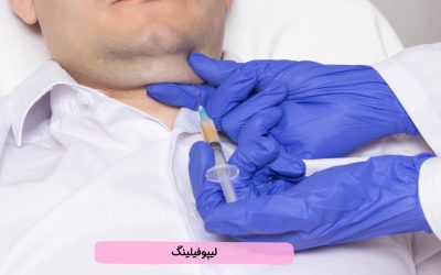 لیپوفیلینگ (Lipofilling) چیست و چه کاربردهایی دارد؟