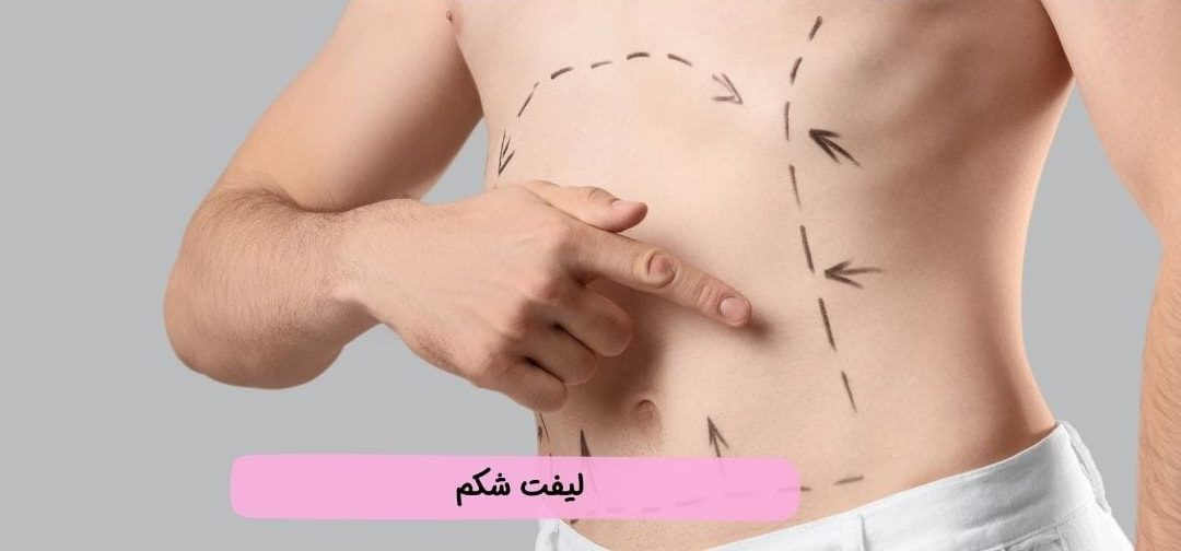 لیفت شکم: راهنمای جامع روشهای جراحی و غیر جراحی