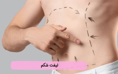 لیفت شکم: راهنمای جامع روشهای جراحی و غیر جراحی