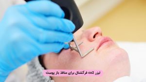درمان منافذ باز پوست با لیزر co2 فرکشنال