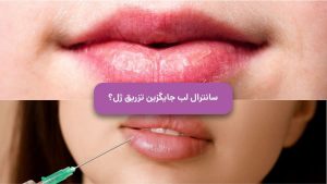 سانترال لب یا فیلر لب