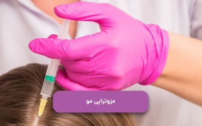 مزوتراپی مو چیست؟ فواید، شرایط و عوارض آن