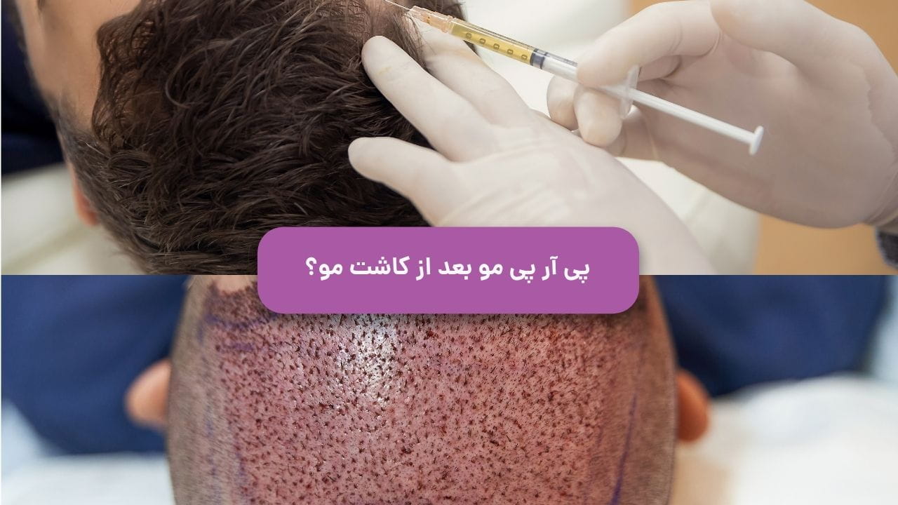 انواع جراحی زیبایی شکم انواع جراحی زیبایی شکم
