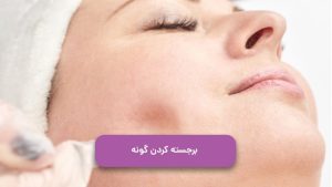 برجسته کردن گونه