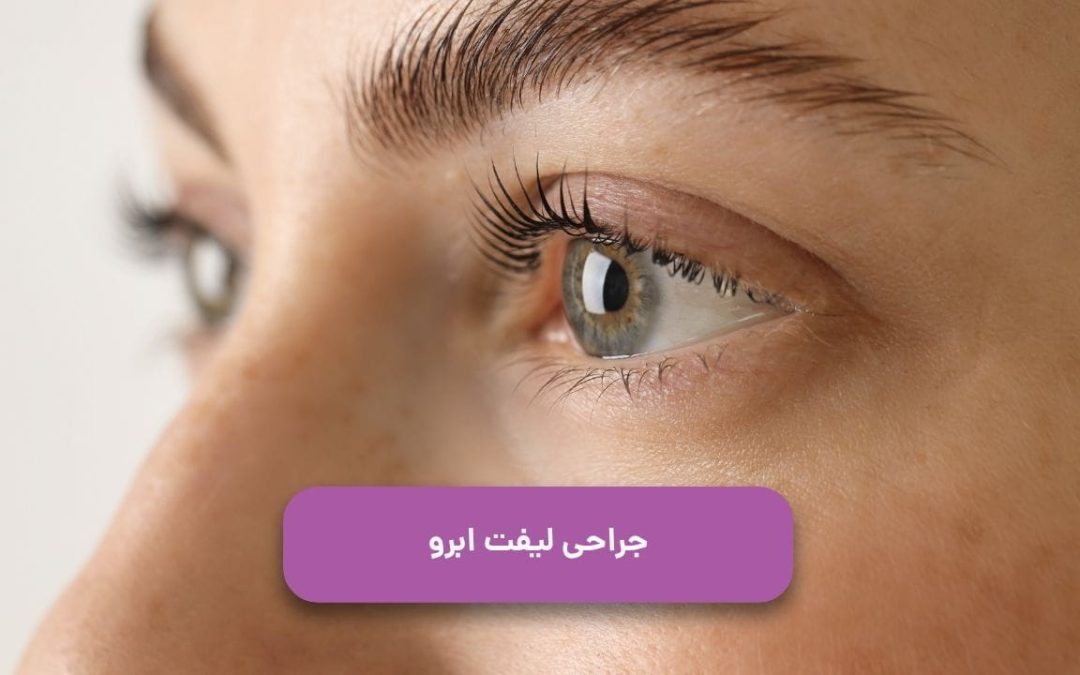 جراحی لیفت ابرو: عوارض، هزینه، روشها، مراقبتهای لازم و میزان ماندگاری