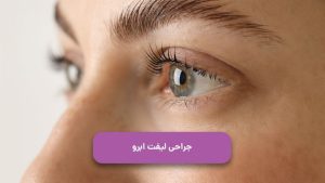 جراحی لیفت ابرو