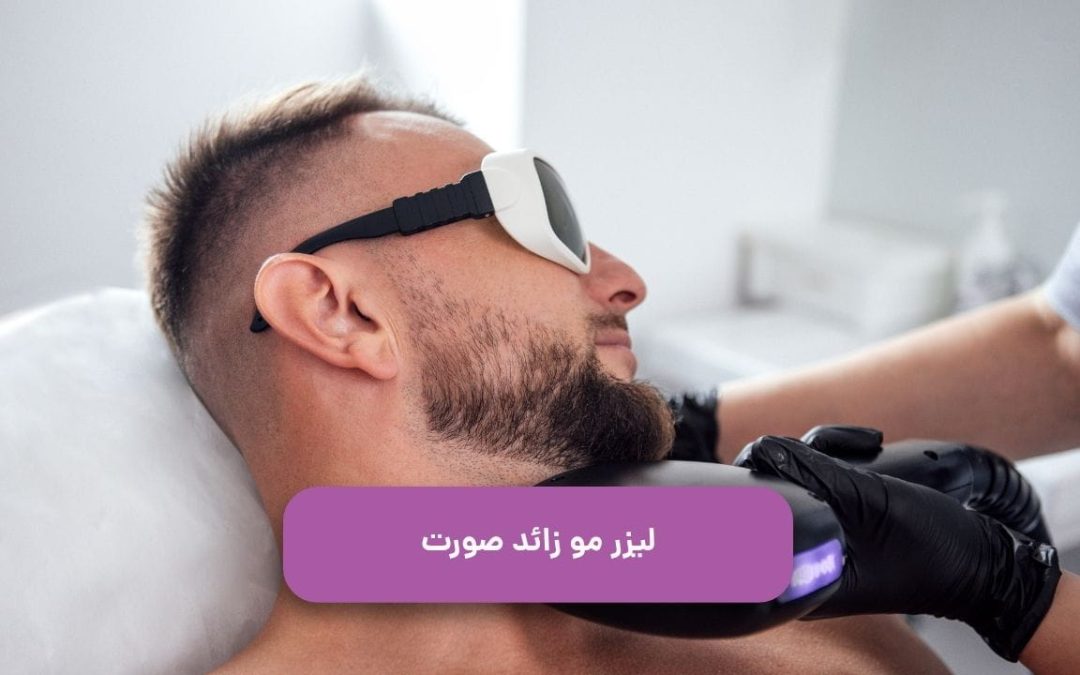 لیزر موهای زائد صورت: مزایا، نکات قبل و بعد و هزینه